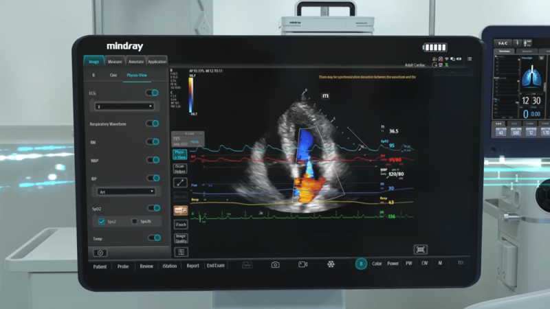 Convoy Funded Mindray Medical TEX20 Ultrasound Machines Commissioned